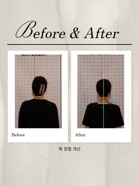 목 정렬 개선 전후 비교 사진